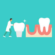 Oral İmplantoloji